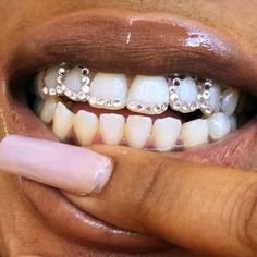 a close up of a person's mouth with braces on it and a finger