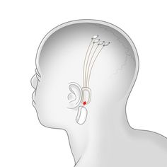 the side view of a man's head with an earpiece attached to it