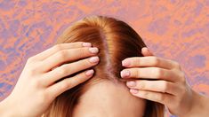 What To Do About Scalp Psoriasis Scaly Scalp, Scalp Scrub, Oily Scalp, Air Dry Hair, Chronic Condition, Dermatologist Recommended, Best Oils, Dermatology