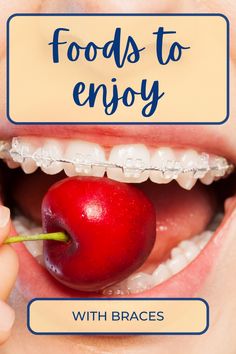 What To Eat With Braces, Braces Before And After, Clear Aligners, Eat And Drink