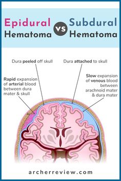 the anatomy of the human brain and what it looks like to be labeled in this diagram