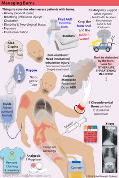 an info poster showing the different types of medical devices and how they are used to treat