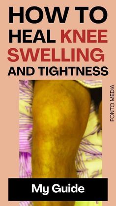 Knee Swelling, Swelling Remedies, Aching Knees, Knee Strengthening, Knee Pain Remedy, Swollen Knee