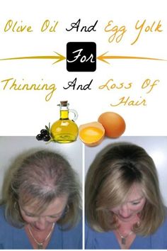 Olive Oil and Egg Yolk For Thinning and Loss Of Hair | Home Remedies And Skin Care Hair Home Remedies, Growing Hair, Helpful Things, Home Remedies For Hair, Thicker Hair, Natural Therapy, Quiche Recipes, Growth Oil