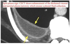 an x - ray shows what is in the chest and where it's located