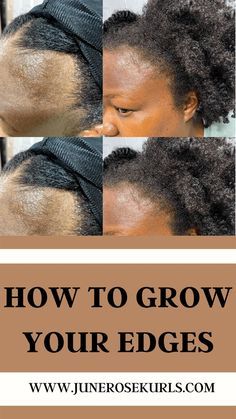 Natural Hair Edges, Hair Edges, Cornrows Natural Hair, Growing Hair, Healthy Hair Tips, After Pregnancy, Hair Tips, Grow Hair, How To Grow