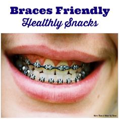 Braces Friendly Healthy Snacks - Snacks For Braces, Food For Braces, Best School Lunches, Soft Snacks, Braces Hacks, Braces Friendly Recipes, Braces Colours, Heathy Snack