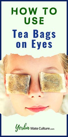 Tea Bags For Eyes Aesthetic, Chamomile Tea Bags For Eyes, Chamomile Eye Compress, Tea Bags On Eyes, Tea Bags For Eyes, Swollen Eyelids Remedy, Tired Eyes Remedy, Teabags For Eyes, Undereye Bags Remedy