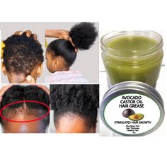 Labor Hairstyles Delivery Black Women, Hair Growth Grease, Oils Benefits, Hair Grease, Rosemary Hair Growth, Black Hair Growth, Rapid Hair Growth, Castor Oil For Hair Growth, Dunner Wordend Haar