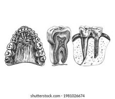 three different types of teeth and gums on a white background, hand drawn illustration