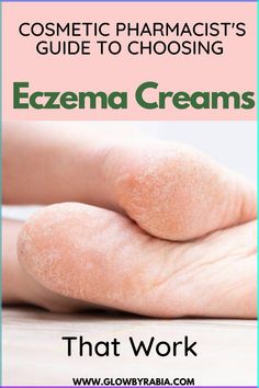 Eczema can be painful and ruin the quality of your daily life, are you tired of trying eczema treatments that don't work? Check out this post written by a dermatology pharmacist on the best eczema treatments and what is recommended by health care professionals to treat eczema fast eczema| how to treat eczema| eczema on face| eczema rash| eczema on hands| eczema in babies|dry skin hacks| how to treat dry skin| creams for eczema Psoriatic Skin, Baby Dry Skin, Skin Hacks, Natural Remedies For Migraines, Health Care Professionals, Dry Skin Remedies, Cream For Dry Skin, Healthy Skin Tips, Manuka Honey