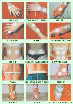 Tennis Elbow, Hand Therapy