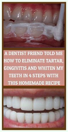 I truly appreciate it. Smashing information! Teeth Whitening Diy, Teeth Health, Natural Healing Remedies, Dental Problems, Teeth Care, Oral Health Care, Natural Health Remedies, Tooth Decay, Natural Home Remedies