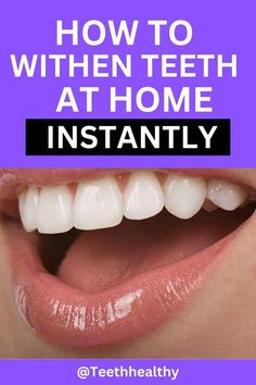 Whiten Teeth Naturally, Natural Teeth Whitening Diy, Teeth Whiting At Home, Tooth Whitening, Teeth Whitening Remedies, Teeth Whitening Diy, Whitening Products, Whiten Teeth, Nice Teeth