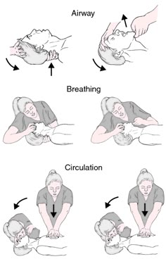 Anesthesia School, Advanced Cardiac Life Support, Breath Sounds, Medical Dictionary