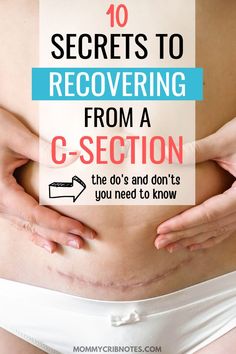 c section, c section recovery, c section hacks, c section tips, c section recovery hacks, c section recovery tips, c section essentials, c section recovery timeline, c section scars, c section dos and donts, c section do's and don'ts postpartum tips, postpartum recovery, new Mom tips, new Mom hacks,  c-section, c-section recovery, c-section hacks, c-section tips, c-section recovery hacks, c-section recovery tips Recovering From C Section, Best Postpartum Belly Wrap, Postpartum Products, C Section Recovery Timeline, Post C Section, C Section Scar, C Section Workout, Scar Healing, Postpartum Must Haves