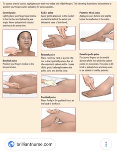 Pulse Points Nursing, Pulses Images, Nursing Information, Nursing Assessment, Nursing School Essential, Nursing School Motivation, Nurse Study Notes, Nursing Student Tips