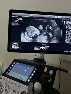 a computer monitor sitting on top of a desk next to an x - ray machine