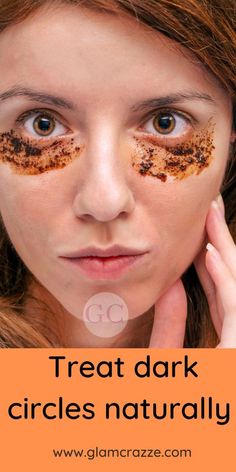 Homemade Remedies For Dark Circles, Dark Eye Circles Remedies, Dark Puffy Circles Under Eyes, Dark Circles Natural Remedy, Black Circles Under Eyes Remedies, Dark Circles Under The Eyes Remedies Natural Treatments, Dark Eye Circles How To Get Rid Of, How To Get Rid Of Dark Circles Under Eye Naturally, How To Fix Dark Circles