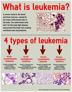 the four types of leukemaa are labeled in red and blue, with an arrow