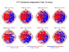 The emergence of energy psychology (EP), including methods such as EFT (emotional freedom techniques), TFT (thought field therapy), Psyche-K... Brain Map, Energy Psychology, Brain Mapping, Cerebral Cortex, Emotional Freedom Technique (eft), Emotional Freedom Technique, Emotional Freedom