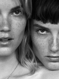 two people with freckles on their faces are looking at the camera