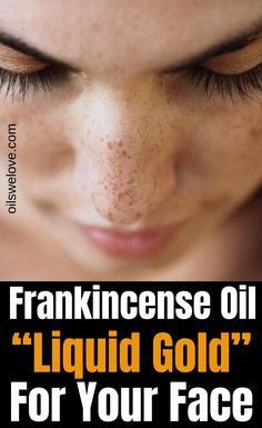 Frankincense Essential Oil Benefits, Frankincense Essential Oil Uses, Essential Oils For Face, Essential Oil Beauty, Essential Oil Diffuser Blends Recipes, Natural Beauty Care, Essential Oils Guide, Essential Oils Herbs, Essential Oils Health