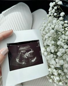 a person holding an x - ray in their left hand next to some white flowers