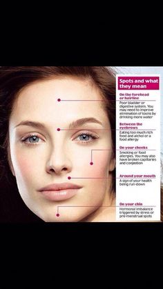 Chest Acne, Face Mapping Acne, Prevent Pimples, Face Mapping, Acne Causes, Treat Acne, Hormonal Acne, Diet Exercise