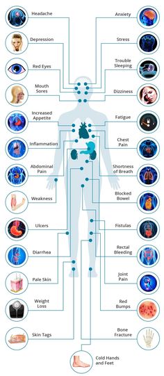 Chrones Disease, Crohns Symptoms, Crohns Diet, Chrons Disease, Digestive Tract, Brain Fog, The Human Body