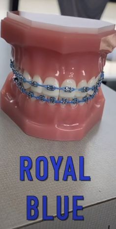 Dark Blue Braces, Light Blue Braces, Pink Braces, Braces Colors Ideas, Jewelry Teeth