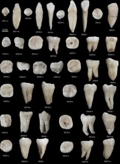 an image of different types of dentals on display in a black background, including teeth and gums