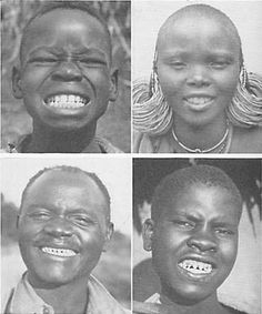 TRADITIONAL FOOD. The development of the faces and dental arches in many African tribes is superb. The girl at the upper right is wearing several earrings in the lobe of each ear. The Wakamba tribe points the teeth as shown below. This does not cause tooth decay while they live on their native food. Dentist Chair, Primal Diet, Phytic Acid, The Dentist, Big Bucks