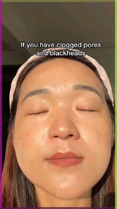 how to clear clogged pores and blackheads ✨ Pores And Blackheads, Brightening Skincare, School Morning, Skincare Serum, Natural Face Skin Care, Simple Skincare Routine, Facial Skin Care Routine, Affordable Skin Care, Unclog Pores