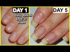 Akordy Na Ukulele, Make Nails Grow, Grow Long Nails, Nail Growth Tips, Grow Nails Faster, Nagel Tips, How To Grow Nails, Brittle Nails, Nail Growth