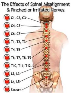 Anatomy Muscles, Spinal Degeneration, Anatomy Medical, Student Tips, Basic Anatomy And Physiology, Accident Injury, Spine Health