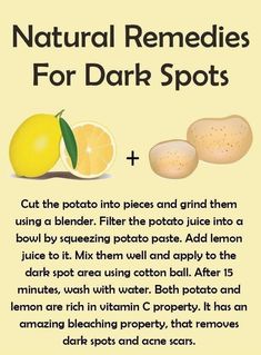 Homemade Skin Care For Dark Spots, Potato Skin Care Dark Spots, Natural Remedies For Dark Spots, Homemade Dark Spot Remover, Potato Face Mask Dark Spots, Natural Face Skin Care For Dark Spots, Fall Facials, How To Remove Dark Spots On Face, Turmeric Face Mask Dark Spots