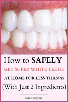 How to Whiten Teeth Naturally | If you want to know how to whiten your teeth at home with baking soda, with coconut oil, and other natural ingredients, this post is for you! While it’s impossible to get pearly whites instantly – or even overnight – without traditional tooth whitening products and procedures, these DIY remedies will allow you to remove stains and discoloration safely. #whitenteeth #teethwhitening #teethwhiteningathome Whiten Teeth Naturally, Whiten Your Teeth At Home, Baking Soda Teeth, Baking Soda Teeth Whitening, Teeth Whitening Methods, Teeth Whitening Homemade, Get Whiter Teeth, Teeth Whitening Remedies, Teeth Whitening Diy