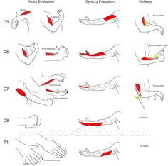 Le Mal A Dit, Physical Therapy School, Physical Therapist Assistant, Occupational Therapist, Physical Therapist, Neurology