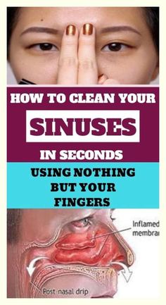 Clear Your Sinuses, Blocked Sinuses, Lymph Drainage Massage, How To Clear Sinuses, Cold Or Allergies, Lymph Fluid, Lymph Drainage, Sinus Pressure, Fluid Retention