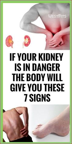 For your health, the kidneys are essential because they detoxify and cleanse the body by filtering 10-150 quarts of blood in a day. Their location is under the rib cage. Their function is to elimin Liv Pure, Kidney Cleanse, Kidney Damage, Kidney Health, Brain Damage, Liver Health, Cardiovascular Health, What Happened To You, Inbound Marketing