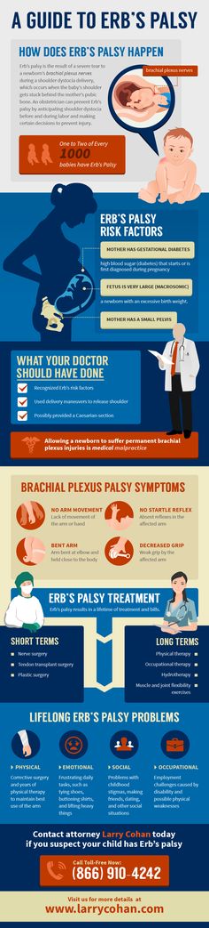 How Does Erb's Palsy Happen Myofunctional Therapy, Health Infographics, Medical Health, Radiology, Health Info