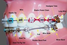 Teeth Design, Dental Anatomy, Dental Fun, Dental Technician, Dental Facts, Dental Life, Orthodontics Braces