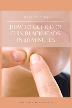 Blackheads are a real problem. They appear on different areas on the face, especially on the nose and chin. How to get rid of chin blackheads in 10 minutes! How To Get Rid Of Chin Blackheads, How To Get Rid Of Blackheads On Chin, Chin Whiteheads, Chin Blackheads, Coldsore Remedies Quick, Home Remedy For Cough, Cold Sores Remedies, Weight Changes