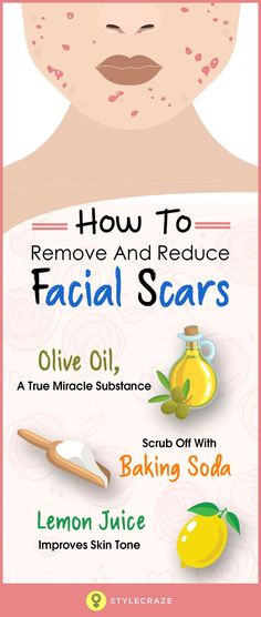 Baking Soda Lemon Juice, Make Up Diy, Facial Scars, Remove Stains, Improve Skin Tone