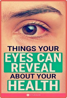 14 Things Your Eyes Are Trying To - Tell You About Your Health by Tracy Smith | This newsletter was created with Smore, an online tool for creating beautiful newsletters for educators, businesses and more Eye Twitching, Blurry Vision, Eye Sight Improvement, School Communication, Vicks Vaporub, Dry Eyes, Eye Health, Blood Vessels