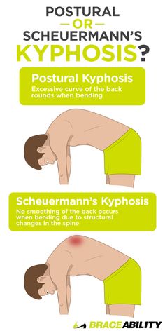 an info poster showing how to use the correct postures for back and neck pain