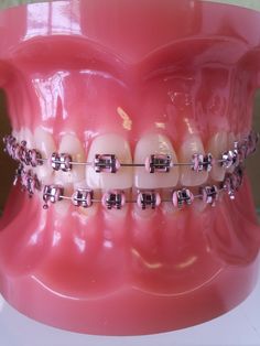 Braces Color Combos, Braces Retainer, Jewelry Teeth, Braces Colors Ideas, Teeth Gems