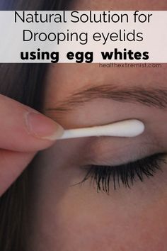 Drooping Eyelids, Hooded Eyelids, Droopy Eyes, Natural Healing Remedies, Diy Remedies, Leaky Gut