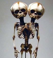 two skeletons standing next to each other on top of a white surface with one skeleton holding the other's head